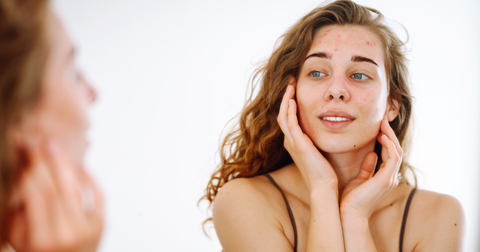 5 Mitos sobre Pele Oleosa que Você Precisa Parar de Acreditar