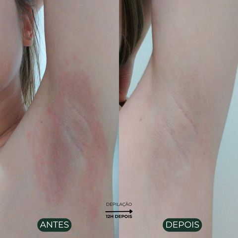 Óleo de Avocado Ozonizado 30ml